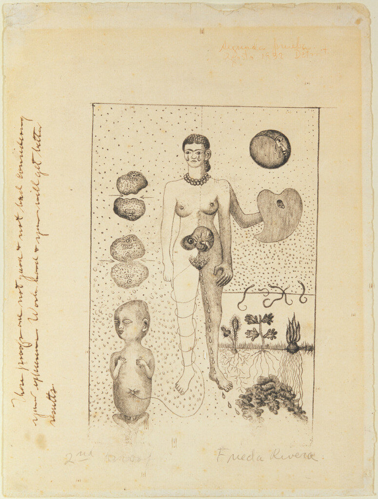 <p>Frida Kahlo, “Frida and the Miscarriage” (“El Aborto”) (1932), lithograph (© ARS, NY; Museo Dolores Olmedo Patiño; photo by Schalkwijk/Art Resource, NY).</p>